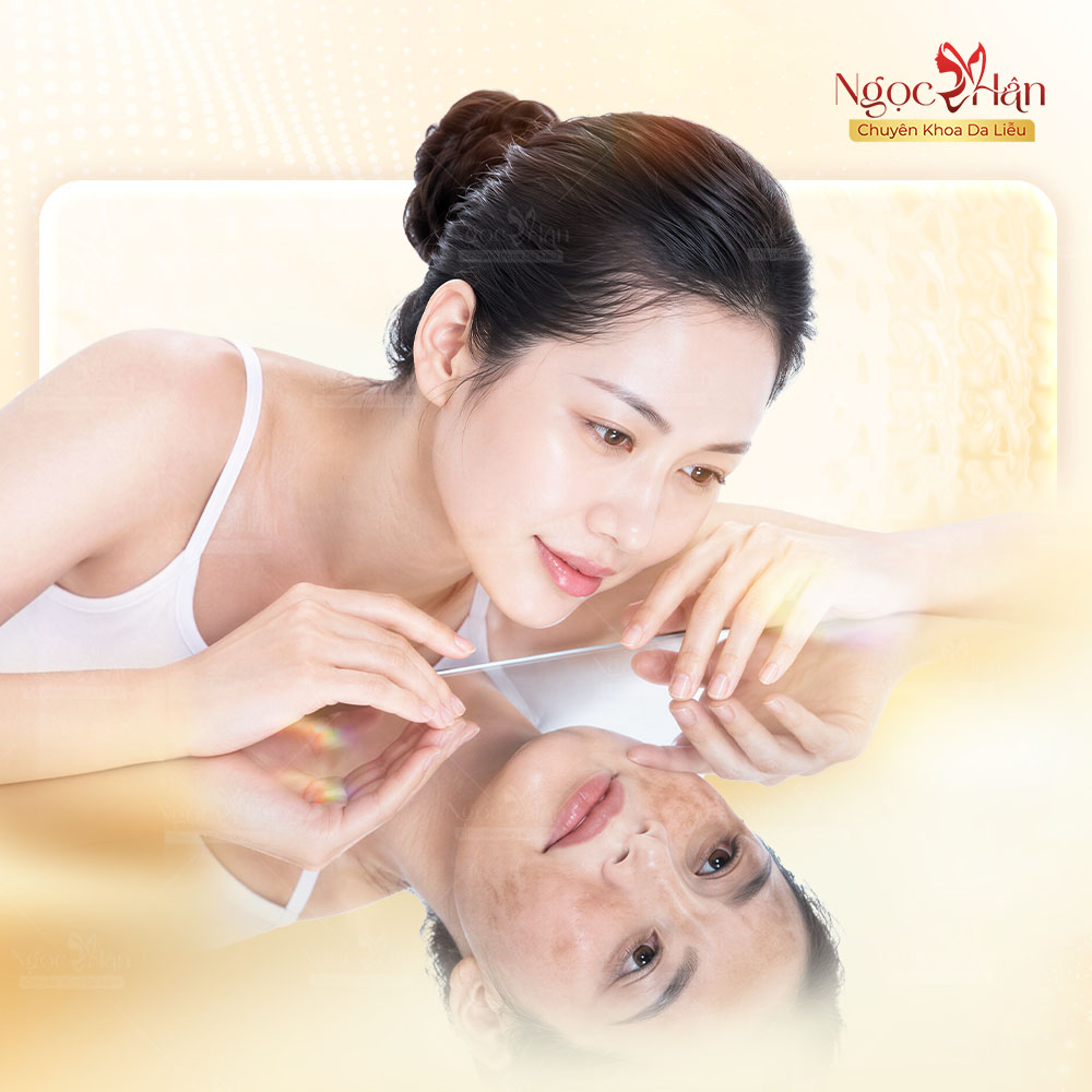 TRỊ NÁM NHIỀU NƠI KHÔNG HẾT: VÌ SAO NÁM VẪN TÁI PHÁT?