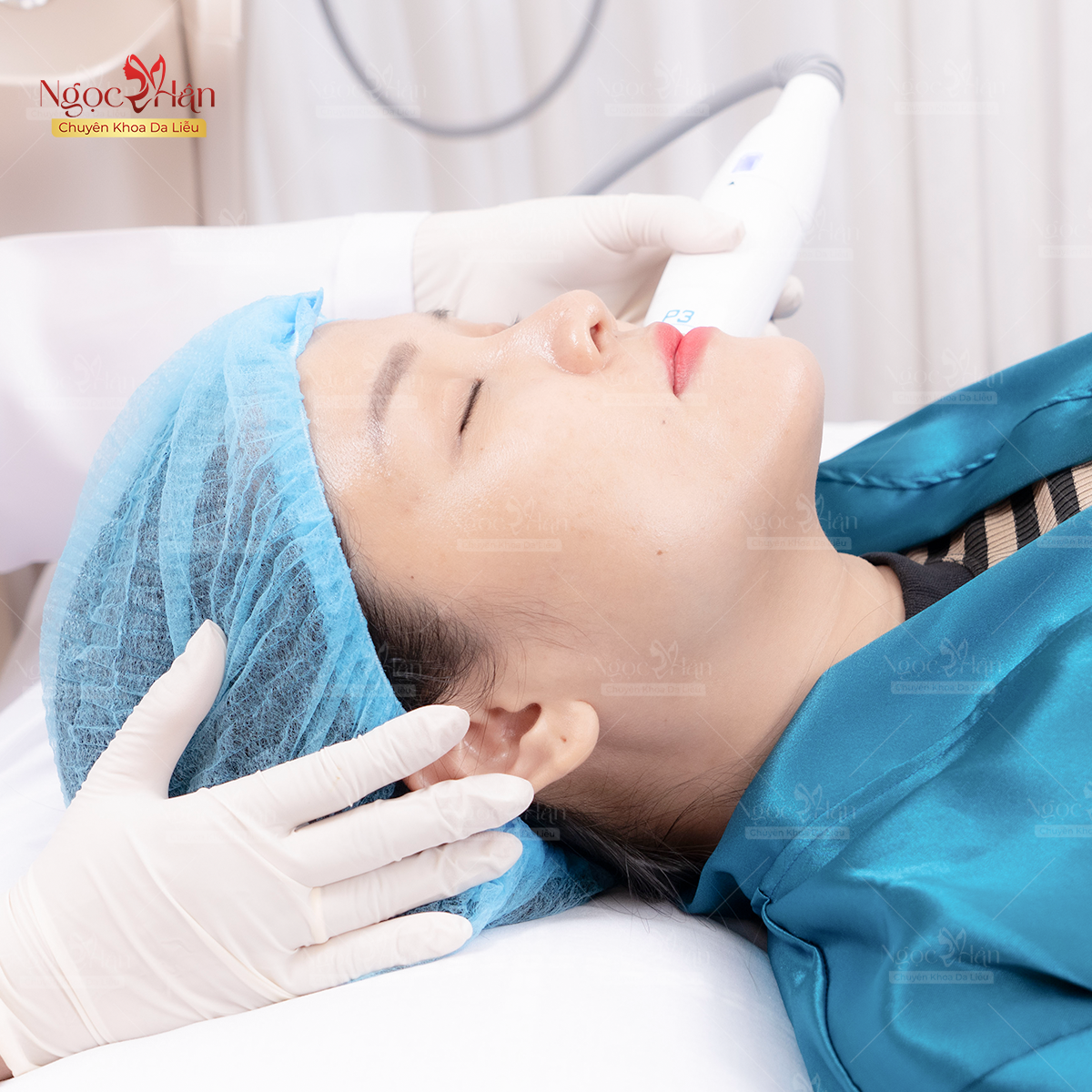 TRỊ NÁM LÂU NĂM CÓ KHÓ KHÔNG? TRỊ NÁM Ở ĐÂU TỐT NHẤT HIỆN NAY