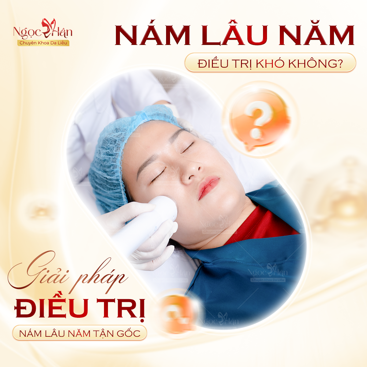 TRỊ NÁM LÂU NĂM CÓ KHÓ KHÔNG? TRỊ NÁM Ở ĐÂU TỐT NHẤT HIỆN NAY