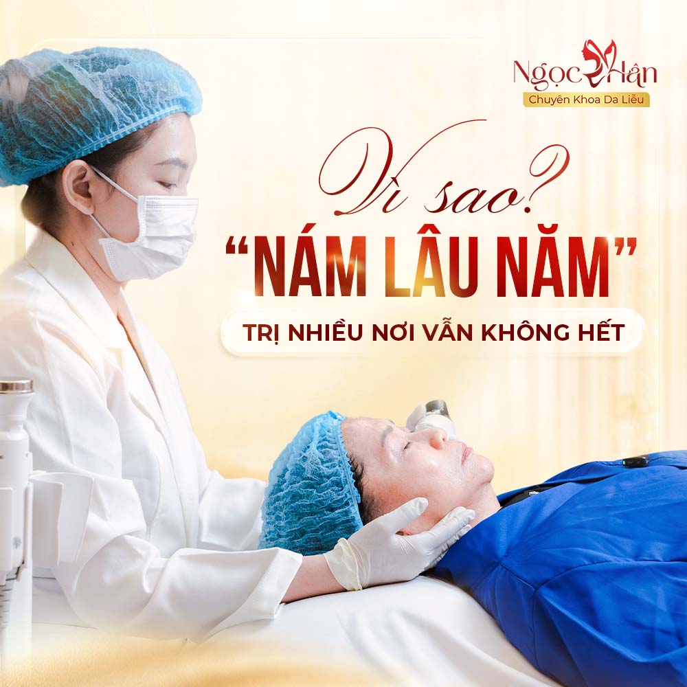 Nám Lâu Năm: Vì Sao Điều Trị Nhiều Lần Nhưng Vẫn Khó Kiểm Soát?
