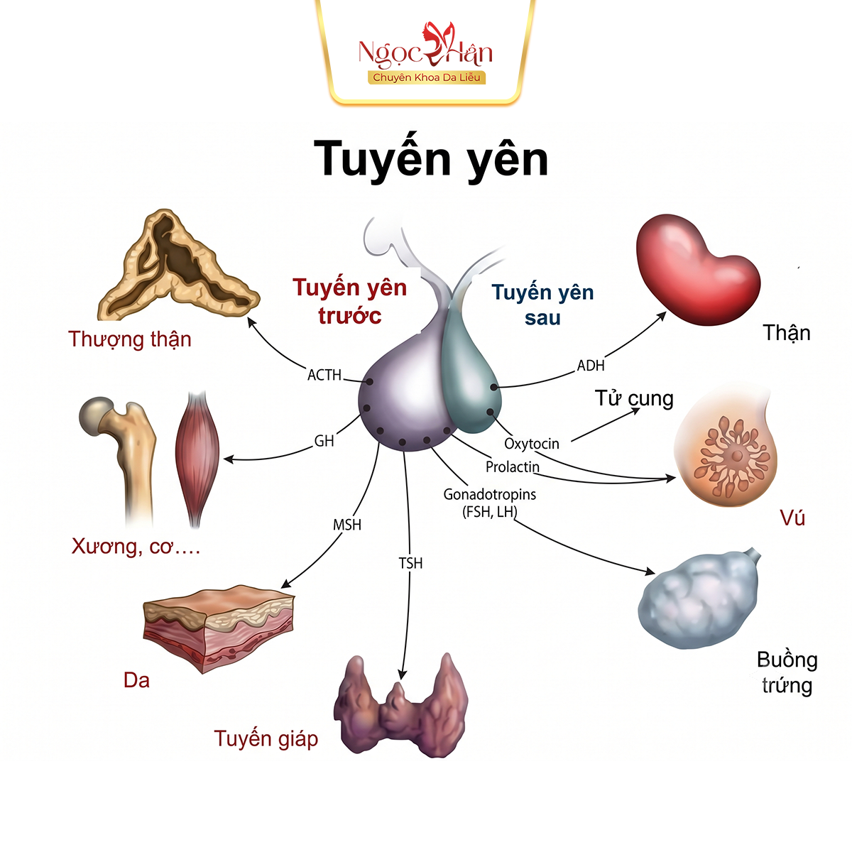 NÁM NỘI TIẾT LÀ GÌ? VÌ SAO CÀNG LỚN TUỔI CÀNG DỄ GẶP?