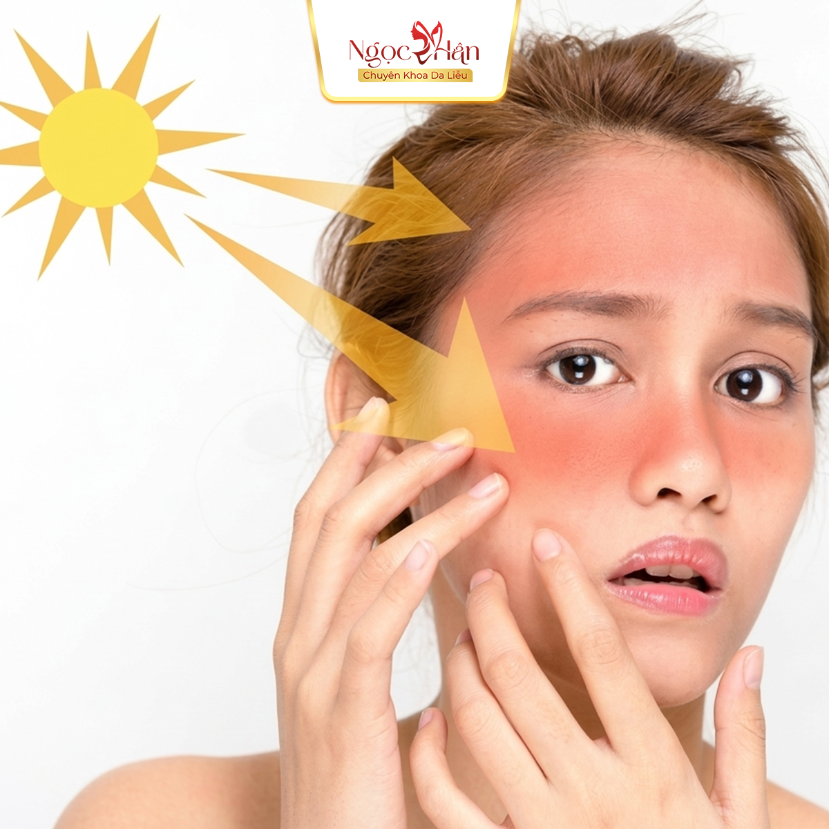 NÁM NỘI TIẾT LÀ GÌ? VÌ SAO CÀNG LỚN TUỔI CÀNG DỄ GẶP?