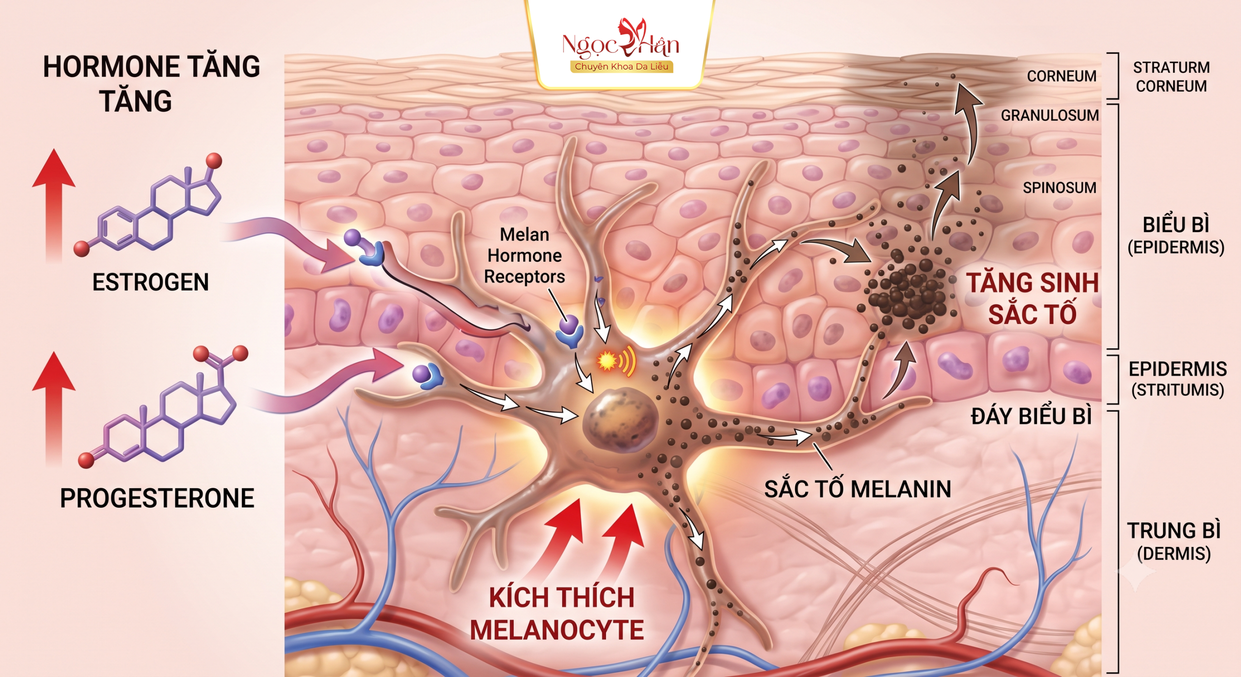 NÁM SAU SINH: NGUYÊN NHÂN, CÁCH ĐIỀU TRỊ NÁM DA SAU SINH HIỆU QUẢ